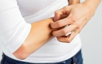 Juckreiz kann als erstes Zeichen der Krankheit bezeichnet werden