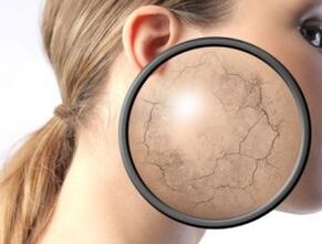 Wie äußert sich Psoriasis