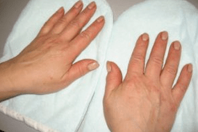 Nagelpsoriasis
